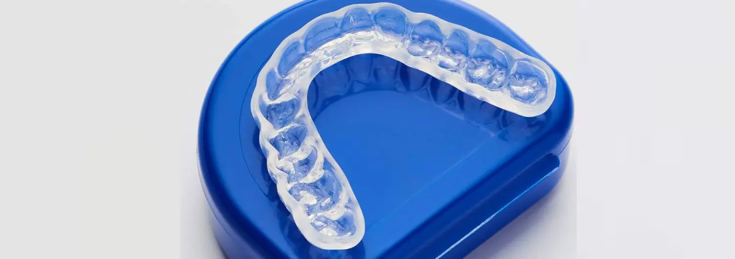 Custom-fitted mouth guard
